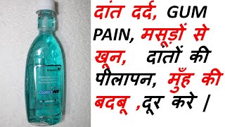 CLOHEX ADS MOUTH WASH  दांत दर्द GUM PAIN PLAQUE मुँह की बदबू दूर करे [upl. by Mathe]