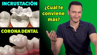 Incrustación vs Corona Dental ¿Cuál te conviene más  Cuando está indicada [upl. by Derina]