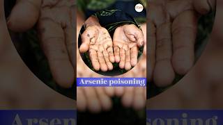 Arsenic poisoning in UP posion harmful up [upl. by Shaughnessy693]