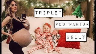 TRIPLET POSTPARTUM BELLY  CARAS POST PREGNANCY LIFE  CHATWIN SIBLING PAJAMA PARTY [upl. by Olga]