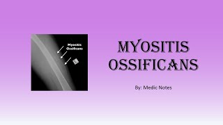 Myositis ossificans  causes symptoms investigation treatment prognosis [upl. by Enaek789]