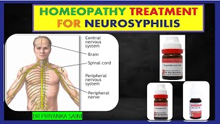 Homeopathic Medicines for Neurosyphilis  Syphilis  brain  spinal cord drpriyankashomeopathy [upl. by Hayidan]