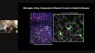 Redefining Microglia States and Function in Alzheimer’s Disease [upl. by Annahs]