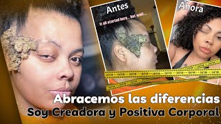 La IMPERFECCIÓN me INSPIRÓ a crear CONTENIDO una HISTORIA de ACEPTACIÓN [upl. by Senilec]