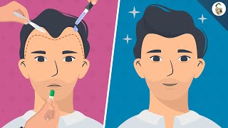 Hair Loss Treatments For Men According To Science [upl. by Akselaw]