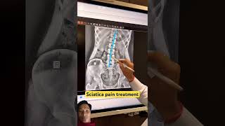 chiropractic chiropractor physiotherapy trending trend ytshort trending cr7 [upl. by Zirkle]