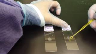 Microbiology the Catalase test [upl. by Rats366]