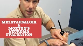 Metatarsalgia and Mortons Neuroma Evaluation and Treatment [upl. by Yehc]