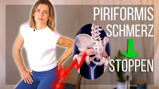 Wie du Schmerzen bei Piriformis Syndrom ANHALTEND beendest Test und Übungen [upl. by Lezlie]