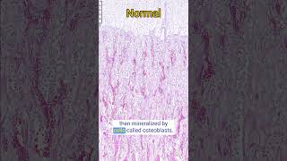 Osteogenesis Imperfecta in a Lamb [upl. by Nelson]