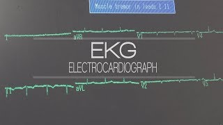 Allied Health  Electrocardiography EKG Technician [upl. by Thatcher]