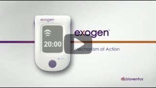 EXOGEN Mechanism of Action us [upl. by Ereveneug]