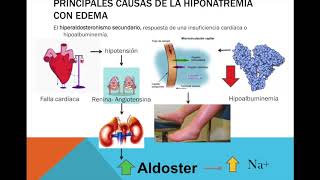 HIPONATREMIA FISIOPATOLOGÍA [upl. by Fields]