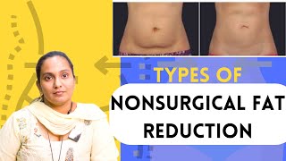 Types Of Nonsurgical Fat Reduction  Injection Lipolysis  Laser Lipolysis  Cryolipolysis [upl. by Moorish]