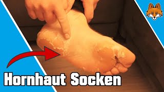 Hornhaut Socken  So einfach Hornhaut entfernen 👣✅ [upl. by Aholah]