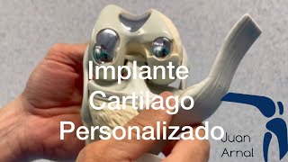 Cartílago Rodilla IMPLANTE PERSONALIZADO [upl. by Noeht]