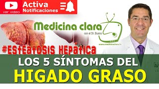 ¿Cómo puedes saber que tienes el hígado graso Los 5 síntomas  Medicina Clara con el Dr Bueno [upl. by Ainivad]