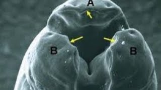 Ascaris Lumbricoides 🪱🪱🪱🪱 [upl. by Ialda]