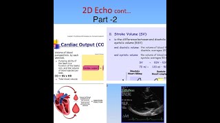 Basics of 2D Echo Part 2in Hindi  What is Ejection Fraction  What is EDV ESV SV and CO [upl. by Ainwat292]