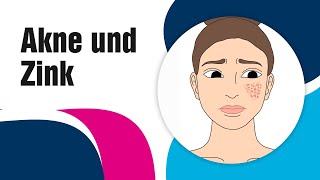 Akne und Zink 2021 Die Wahrheit in 100 Sekunden [upl. by Eilegna431]