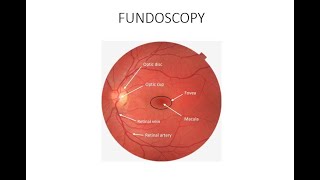 HOW TO DO FUNDOSCOPY OR OPHTHALMOSCOPY [upl. by Annoif]