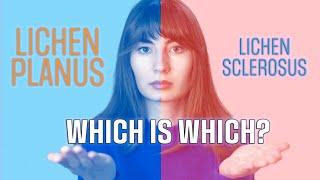 Lichen Sclerosus and lichen planus whats the difference [upl. by Sredna]