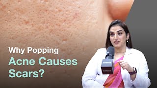 How Can Popping Pimples Leads to Acne Scars [upl. by Smoot433]