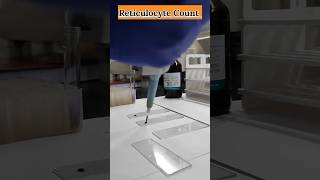 Reticulocyte Count Full Process youtubeshorts viral shortsvideo dmlt ytviral feedshorts [upl. by Liv]