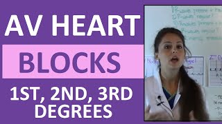 How to Interpret AV Heart Blocks Ekg Heart Rhythms  1st degree 2nd degree 3rd degree difference [upl. by Avis]