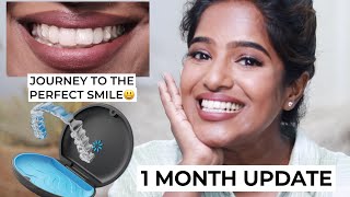 Things to know before Getting Invisalign🙃One month of using aligners🤯Tamil Guide [upl. by Rosmarin]