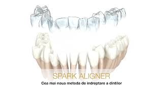 Aparat dentar SPARK [upl. by Nygem]