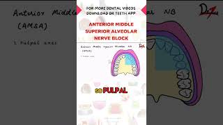 Anterior Middle Superior Alveolar Nerve Block [upl. by Margalit]