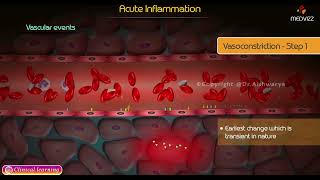 Acute Inflammation Animation  Pathology [upl. by Aeduj]