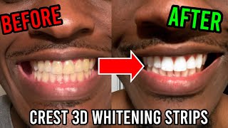 Review of Crest 3D Whitestrips  Professional Effects  20 Years of Experience [upl. by Rector46]