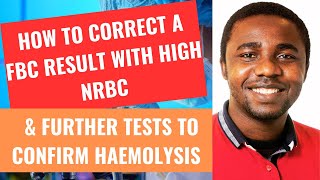 How to correct a FBC result with high NRBC amp further tests to confirm haemolysis [upl. by Caraviello]