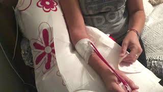 Solo Self Needling Video Home Haemodialysis [upl. by Templia]