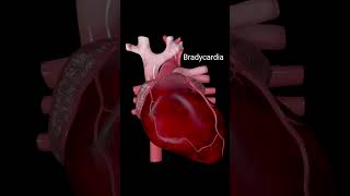 Heart anatomy heartattack heartbeat bradycardia 3danimation [upl. by Sicular]