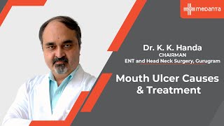 Mouth Ulcer Causes amp Treatment  Dr K K Handa  Medanta Gurugram [upl. by Anastasius]