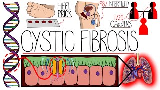 Understanding Cystic Fibrosis Includes Pathophysiology amp Diagnosis [upl. by Auqined]