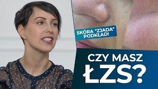 Zaczerwieniona skóra łuszczące skórki schodzący podkład Łojotokowe zapalenie skóry  pielęgnacja [upl. by Adiari]