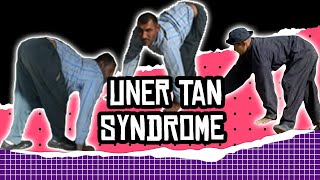 Weird Health News Uner Tan Syndrome [upl. by Antin]