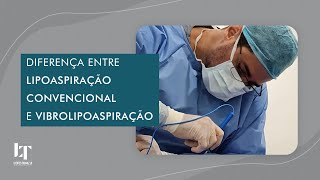 DIFERENÇA ENTRE VIBROLIPO E LIPOASPIRAÇÃO [upl. by Guthry]