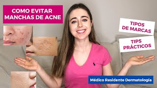 COMO EVITAR MANCHAS DE ACNE  TIPS PARA MARCAS DE ACNE  TIPOS DE MARCAS DE ACNE  DERMATOLOGIA [upl. by Elder11]