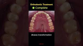 trending dentist dentalclinic orthodontist dental smile braces dentistry shorts yt bds [upl. by Milka8]