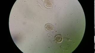 Fertilised decorticated egg of Ascaris lumbricoides [upl. by Daren]