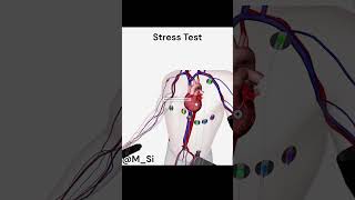 Stress Test [upl. by Qerat]