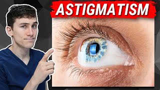 Astigmatism Explained  What You Need to Know [upl. by Yahska223]