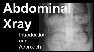 Abdominal Xray Introduction and Approach [upl. by Alyakem]