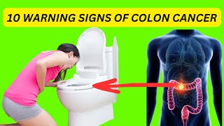 EARLY WARNING SIGNS OF COLON CANCER YOU SHOULD NOT IGNORE [upl. by Eekorehc293]