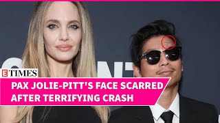 VIRAL Angelina Jolies Son Pax Shows Off Scars At Toronto Festival Post Two Brutal Accidents [upl. by Edmonds]